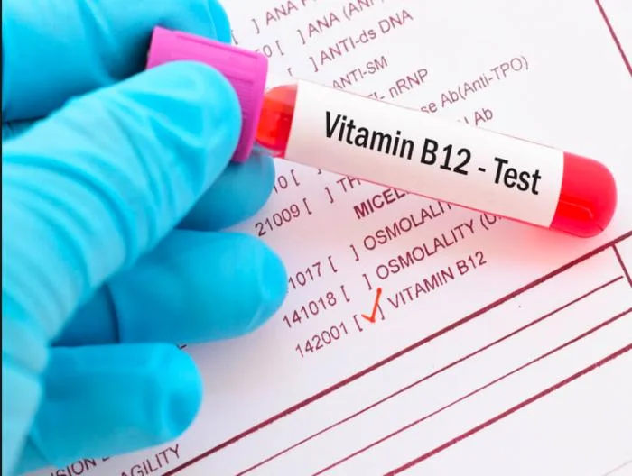 Vitamin B12 Testi