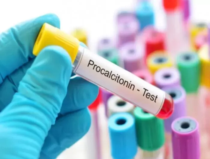 PCT Nedir? Kapak Resmi