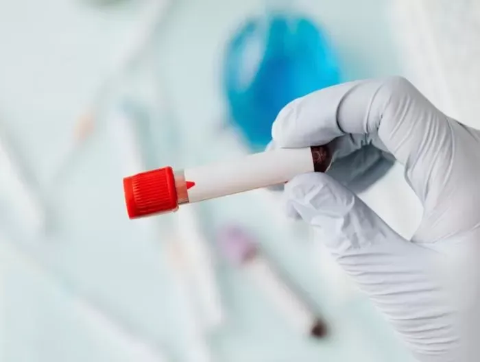 Wbc Yüksekliği Nedir?