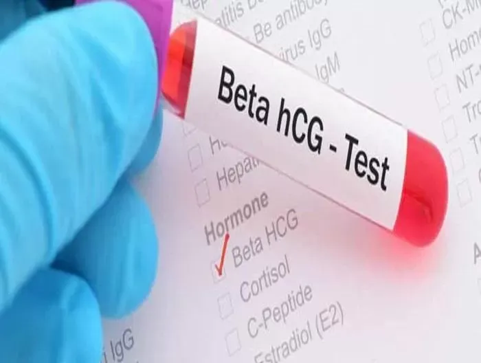 Beta HCG Değerleri Nedir?