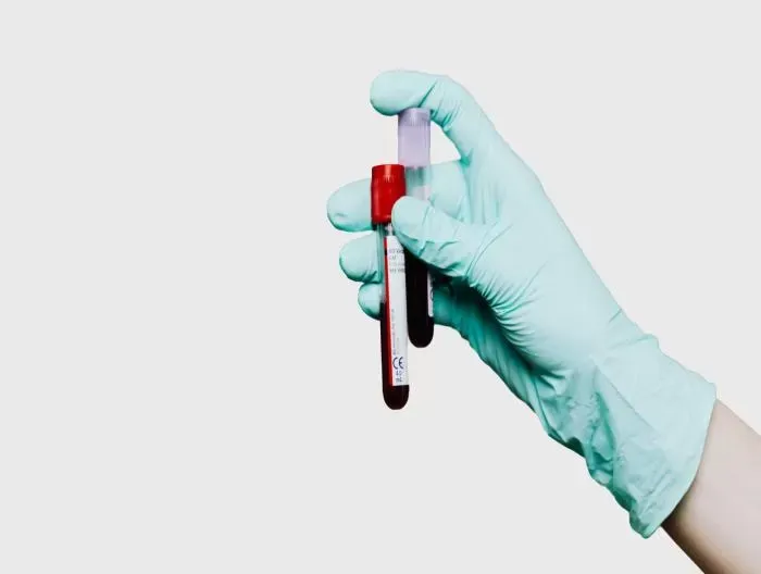 CRP Türbidimetrik Nedir?