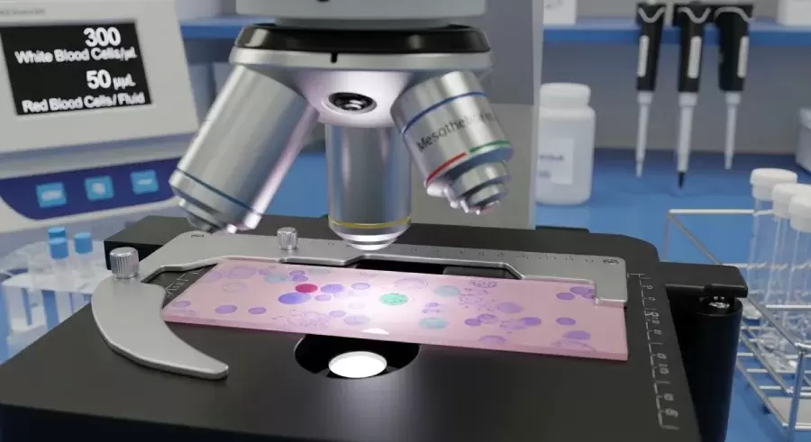 Plevra Periton Sıvısında Hücre Sayımı Kapak Resmi