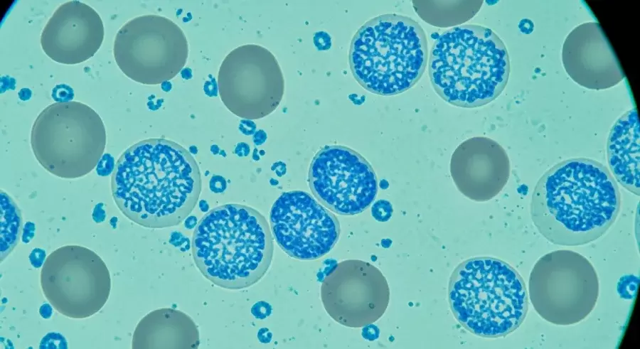 Retikülosit Boyama Kapak Resmi