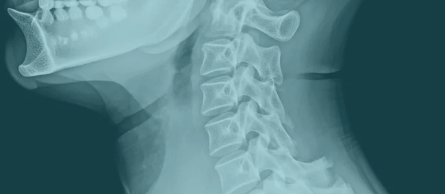 Satem Mobil Sağlık ile Güvenli, Hızlı ve Etkin Servikal Grafi Hizmetine Ulaşın Resmi