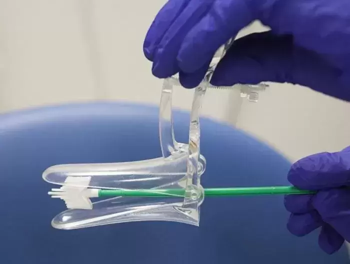 Smear testi