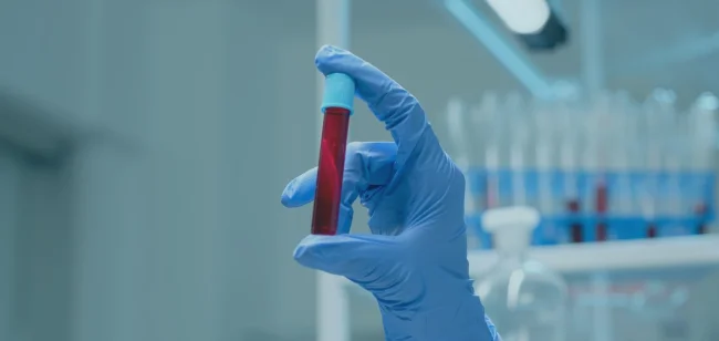 Eskişehir Toksikolojik Testler Hizmeti Resmi