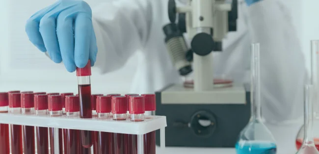 Satem Mobil Sağlık ile Potansiyel Toksinlere Karşı Vücudunuzu Koruyun ve Sağlıklı Bir Yaşama Adım Atın Resmi