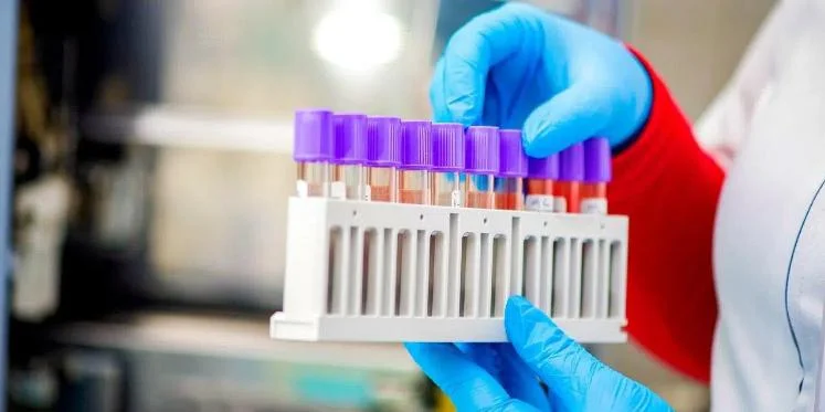 PCR Antikor Testi